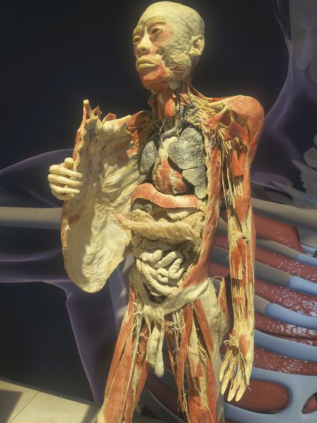 This image shows a plastinated human cadaver in a museum setting, standing with its chest cavity exposed to reveal the heart, lungs, and intestines while holding a large, detached flap of skin in its right hand. The figure features detailed reddish-orange muscle tissue and preserved facial skin, positioned against a dark background that includes large, purple-hued anatomical illustrations.